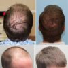 Hair Care Hair Growth Essential Oils Essence Original Authentic 100% Hair Loss Liquid Health Care Beauty Dense Hair Growth Serum