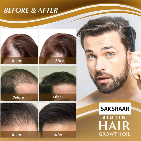 SAKSRAAR Hair Growth Essential Oils Essence 100% Original Anti Hair Loss Products Treatment Health Care Beauty Hair Growth Serum