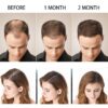 SAKSRAAR Hair Growth Essential Oils Essence 100% Original Anti Hair Loss Products Treatment Health Care Beauty Hair Growth Serum