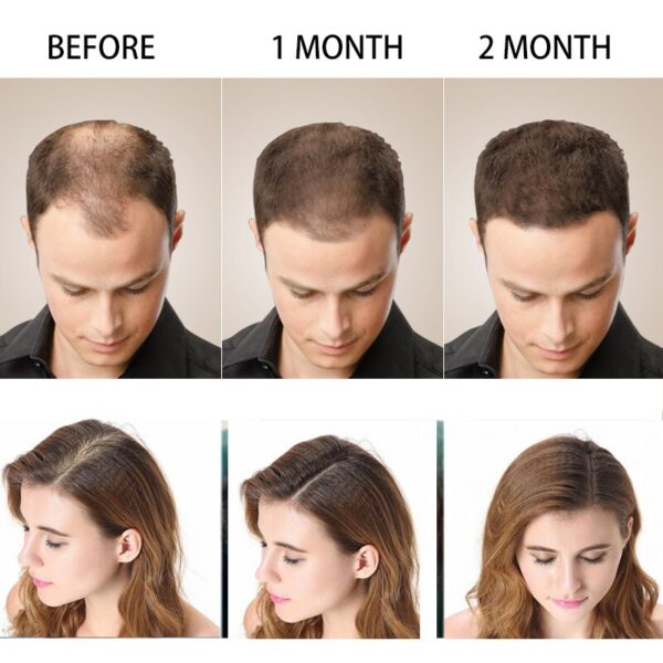 SAKSRAAR Hair Growth Essential Oils Essence 100% Original Anti Hair Loss Products Treatment Health Care Beauty Hair Growth Serum